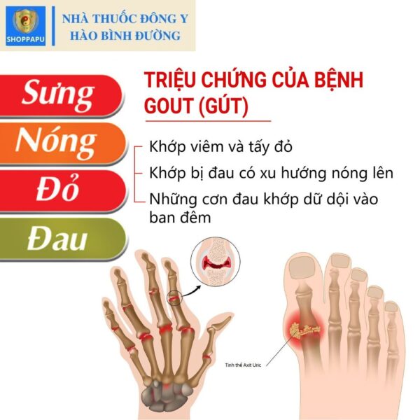 Hao Binh Bo Huyet, Hao Binh Bo Than Sinh Tinh, Hao Binh Bo Ty, Hao Binh Da Day Dan, Hao Binh Da Nang Buong Trung, Hao Binh Gan, Hao Binh Gan (Mun, Viem Da, Ngua,...), Hao Binh Giam Can, Hao Binh Gout, Hao Binh Khop Dan, Hao Binh On Dinh Huyet Ap, Hao Binh Tam Dan, Hao Binh Than Dan, Hao Binh Tien Dan, Hao Binh Tieu Duong Dan, Hao Binh Tieu U Buou, Hao Binh Tri Noi Tri Ngoai, Hao Binh Viem Phu Khoa, Hao Binh Viem Xoang, Hao Binh Suy Gian Tinh Mach, Hao Binh Tieu Dem, Hao Binh Vien Dieu Kinh Hao Binh Vien Cam Cum