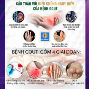Hao Binh Bo Huyet, Hao Binh Bo Than Sinh Tinh, Hao Binh Bo Ty, Hao Binh Da Day Dan, Hao Binh Da Nang Buong Trung, Hao Binh Gan, Hao Binh Gan (Mun, Viem Da, Ngua,...), Hao Binh Giam Can, Hao Binh Gout, Hao Binh Khop Dan, Hao Binh On Dinh Huyet Ap, Hao Binh Tam Dan, Hao Binh Than Dan, Hao Binh Tien Dan, Hao Binh Tieu Duong Dan, Hao Binh Tieu U Buou, Hao Binh Tri Noi Tri Ngoai, Hao Binh Viem Phu Khoa, Hao Binh Viem Xoang, Hao Binh Suy Gian Tinh Mach, Hao Binh Tieu Dem, Hao Binh Vien Dieu Kinh Hao Binh Vien Cam Cum