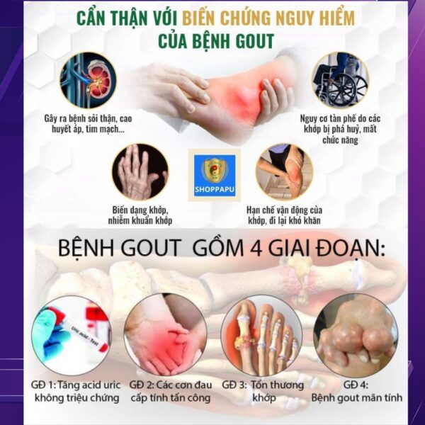 Hao Binh Bo Huyet, Hao Binh Bo Than Sinh Tinh, Hao Binh Bo Ty, Hao Binh Da Day Dan, Hao Binh Da Nang Buong Trung, Hao Binh Gan, Hao Binh Gan (Mun, Viem Da, Ngua,...), Hao Binh Giam Can, Hao Binh Gout, Hao Binh Khop Dan, Hao Binh On Dinh Huyet Ap, Hao Binh Tam Dan, Hao Binh Than Dan, Hao Binh Tien Dan, Hao Binh Tieu Duong Dan, Hao Binh Tieu U Buou, Hao Binh Tri Noi Tri Ngoai, Hao Binh Viem Phu Khoa, Hao Binh Viem Xoang, Hao Binh Suy Gian Tinh Mach, Hao Binh Tieu Dem, Hao Binh Vien Dieu Kinh Hao Binh Vien Cam Cum