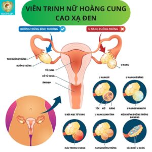 vien trinh nu hoang cung cao xa den7