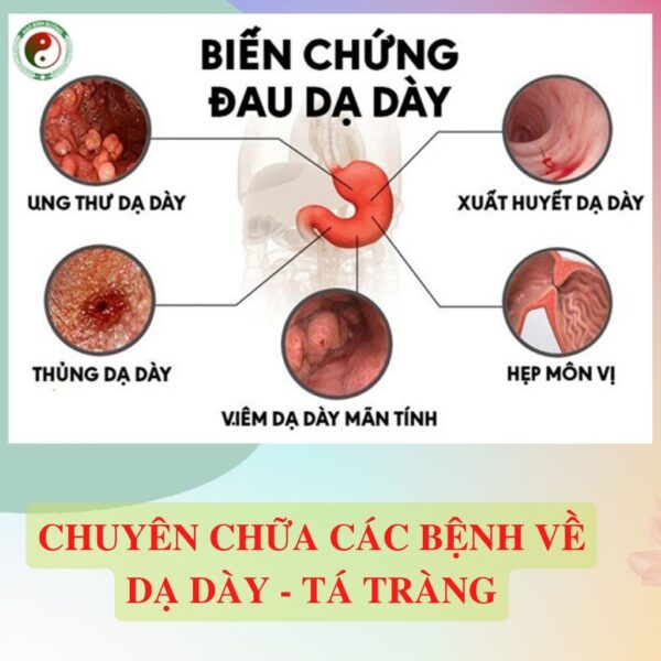 La Da Day Dan Toc Dao Giup Tieu Hoa Tot Giup An Ngon Giam Day Bung5