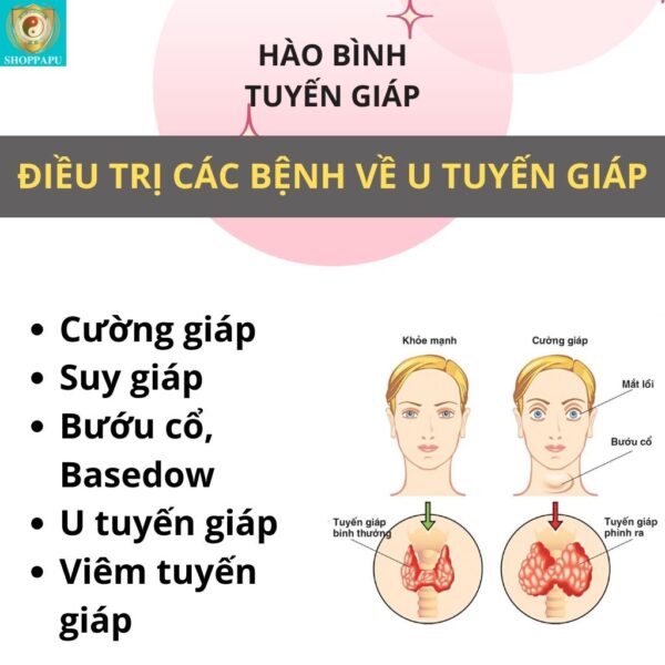 Hao Binh Bo Huyet, Hao Binh Bo Than Sinh Tinh, Hao Binh Bo Ty, Hao Binh Da Day Dan, Hao Binh Da Nang Buong Trung, Hao Binh Gan, Hao Binh Gan (Mun, Viem Da, Ngua,...), Hao Binh Giam Can, Hao Binh Gout, Hao Binh Khop Dan, Hao Binh On Dinh Huyet Ap, Hao Binh Tam Dan, Hao Binh Than Dan, Hao Binh Tien Dan, Hao Binh Tieu Duong Dan, Hao Binh Tieu U Buou, Hao Binh Tri Noi Tri Ngoai, Hao Binh Viem Phu Khoa, Hao Binh Viem Xoang, Hao Binh Suy Gian Tinh Mach, Hao Binh Tieu Dem, Hao Binh Vien Dieu Kinh Hao Binh Vien Cam Cum