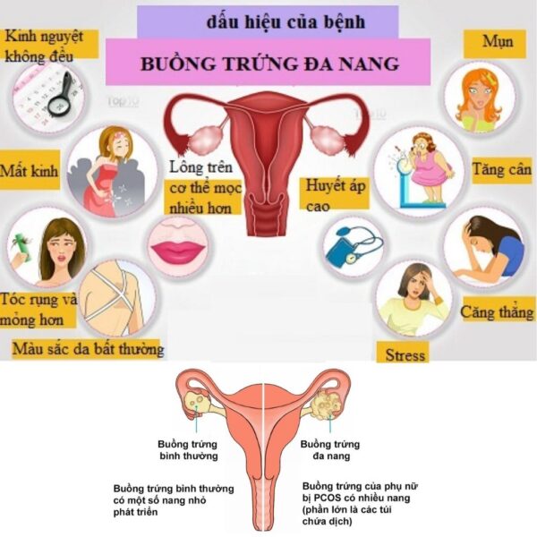 Hao Binh Bo Huyet, Hao Binh Bo Than Sinh Tinh, Hao Binh Bo Ty, Hao Binh Da Day Dan, Hao Binh Da Nang Buong Trung, Hao Binh Gan, Hao Binh Gan (Mun, Viem Da, Ngua,...), Hao Binh Giam Can, Hao Binh Gout, Hao Binh Khop Dan, Hao Binh On Dinh Huyet Ap, Hao Binh Tam Dan, Hao Binh Than Dan, Hao Binh Tien Dan, Hao Binh Tieu Duong Dan, Hao Binh Tieu U Buou, Hao Binh Tri Noi Tri Ngoai, Hao Binh Viem Phu Khoa, Hao Binh Viem Xoang, Hao Binh Suy Gian Tinh Mach, Hao Binh Tieu Dem, Hao Binh Vien Dieu Kinh Hao Binh Vien Cam Cum