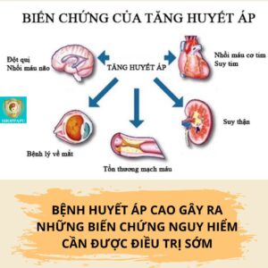 Hao Binh Bo Huyet, Hao Binh Bo Than Sinh Tinh, Hao Binh Bo Ty, Hao Binh Da Day Dan, Hao Binh Da Nang Buong Trung, Hao Binh Gan, Hao Binh Gan (Mun, Viem Da, Ngua,...), Hao Binh Giam Can, Hao Binh Gout, Hao Binh Khop Dan, Hao Binh On Dinh Huyet Ap, Hao Binh Tam Dan, Hao Binh Than Dan, Hao Binh Tien Dan, Hao Binh Tieu Duong Dan, Hao Binh Tieu U Buou, Hao Binh Tri Noi Tri Ngoai, Hao Binh Viem Phu Khoa, Hao Binh Viem Xoang, Hao Binh Suy Gian Tinh Mach, Hao Binh Tieu Dem, Hao Binh Vien Dieu Kinh Hao Binh Vien Cam Cum