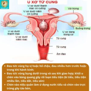 Hao Binh Bo Huyet, Hao Binh Bo Than Sinh Tinh, Hao Binh Bo Ty, Hao Binh Da Day Dan, Hao Binh Da Nang Buong Trung, Hao Binh Gan, Hao Binh Gan (Mun, Viem Da, Ngua,...), Hao Binh Giam Can, Hao Binh Gout, Hao Binh Khop Dan, Hao Binh On Dinh Huyet Ap, Hao Binh Tam Dan, Hao Binh Than Dan, Hao Binh Tien Dan, Hao Binh Tieu Duong Dan, Hao Binh Tieu U Buou, Hao Binh Tri Noi Tri Ngoai, Hao Binh Viem Phu Khoa, Hao Binh Viem Xoang, Hao Binh Suy Gian Tinh Mach, Hao Binh Tieu Dem, Hao Binh Vien Dieu Kinh Hao Binh Vien Cam Cum