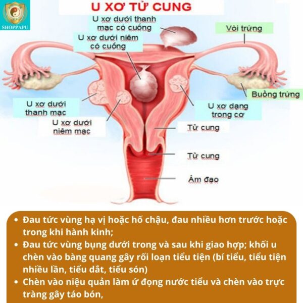 Hao Binh Bo Huyet, Hao Binh Bo Than Sinh Tinh, Hao Binh Bo Ty, Hao Binh Da Day Dan, Hao Binh Da Nang Buong Trung, Hao Binh Gan, Hao Binh Gan (Mun, Viem Da, Ngua,...), Hao Binh Giam Can, Hao Binh Gout, Hao Binh Khop Dan, Hao Binh On Dinh Huyet Ap, Hao Binh Tam Dan, Hao Binh Than Dan, Hao Binh Tien Dan, Hao Binh Tieu Duong Dan, Hao Binh Tieu U Buou, Hao Binh Tri Noi Tri Ngoai, Hao Binh Viem Phu Khoa, Hao Binh Viem Xoang, Hao Binh Suy Gian Tinh Mach, Hao Binh Tieu Dem, Hao Binh Vien Dieu Kinh Hao Binh Vien Cam Cum