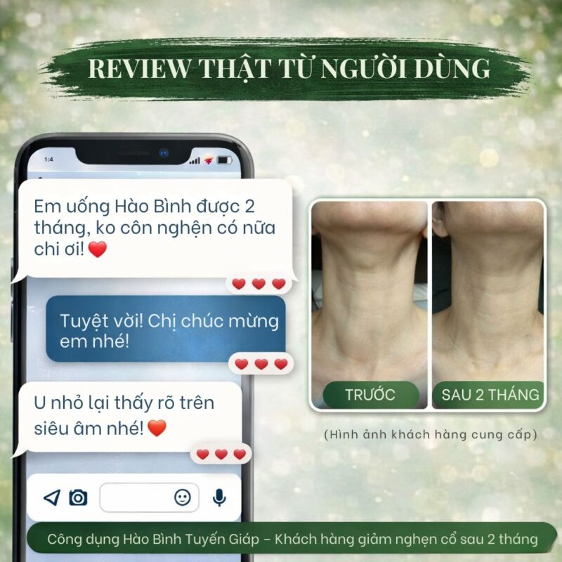 🧠 Hào Bình Tuyến Giáp là gì? Sự thật về sản phẩm đang được tìm kiếm nhiều trên Google Công dụng Hào Bình Tuyến Giáp – Khách hàng giảm nghẹn cổ sau 2 tháng